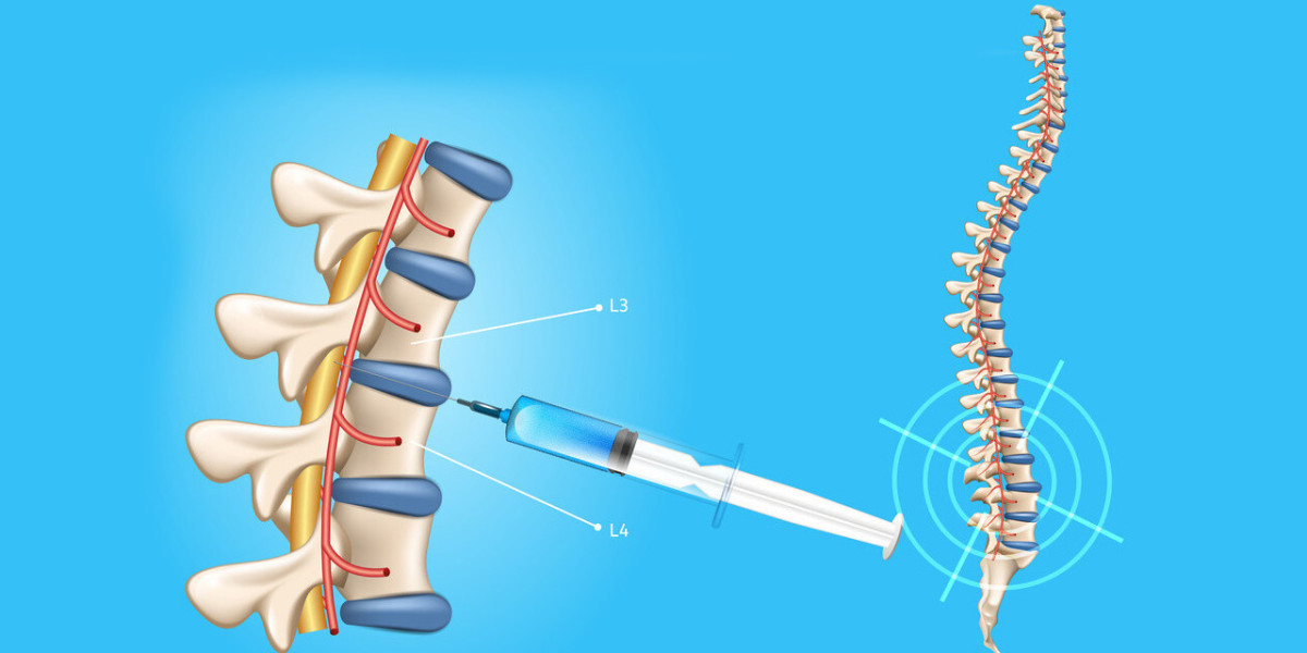 Spinal Needles Market is Booming Worldwide | Industry Research Report With Top Key Players