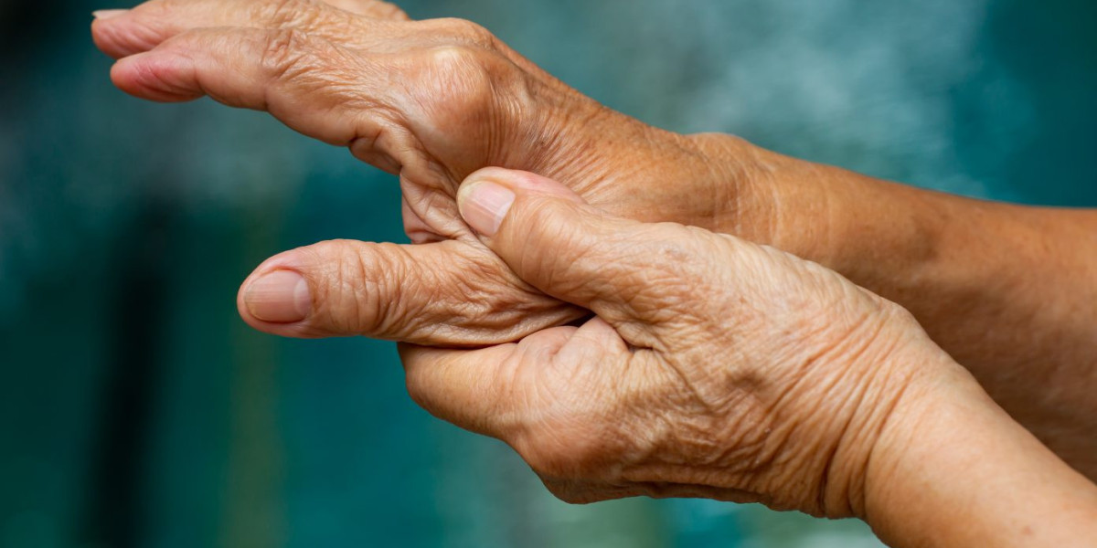 Thumb Arthritis Market is Rising Prevalence