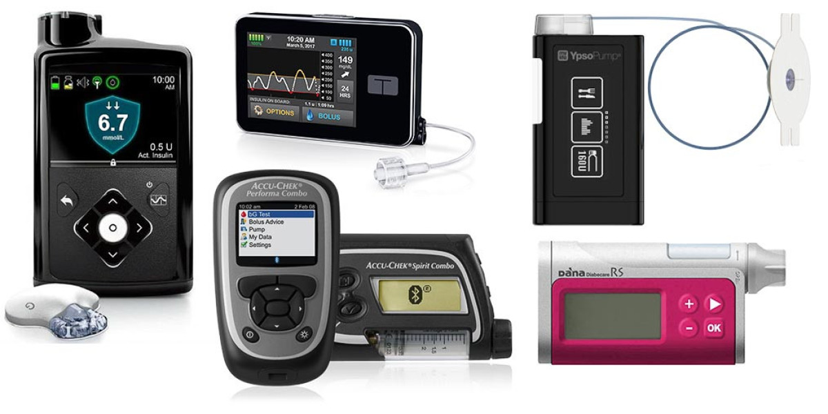 Continuous Care: Exploring the Evolution of Insulin Pump Technology
