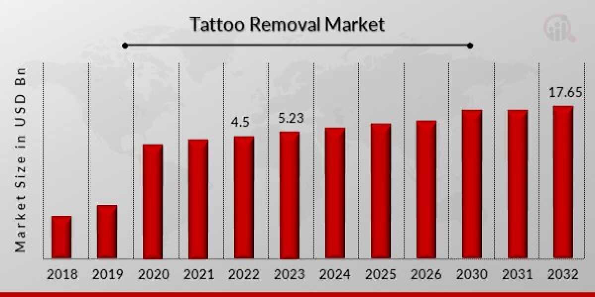 Laser Tattoo Removal: Technology Drives Growth in Tattoo Removal Market