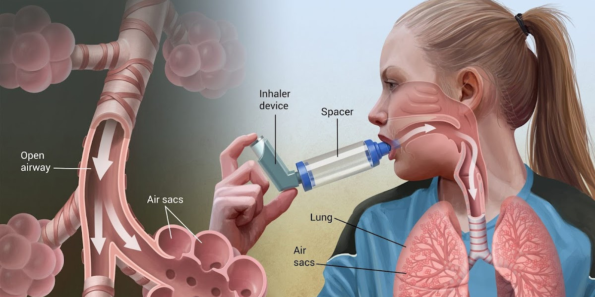Global Asthma Inhaler Device Market Share to Produce a High Profit