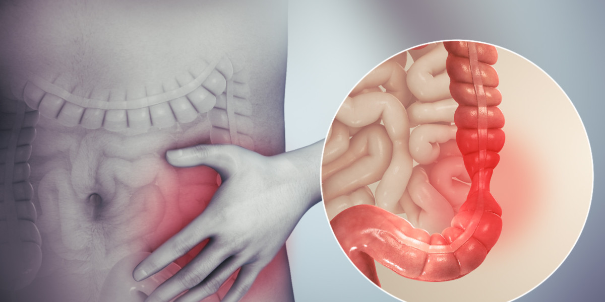 Revolutionizing Gut Health: Cutting-Edge Solutions for Irritable Bowel Syndrome