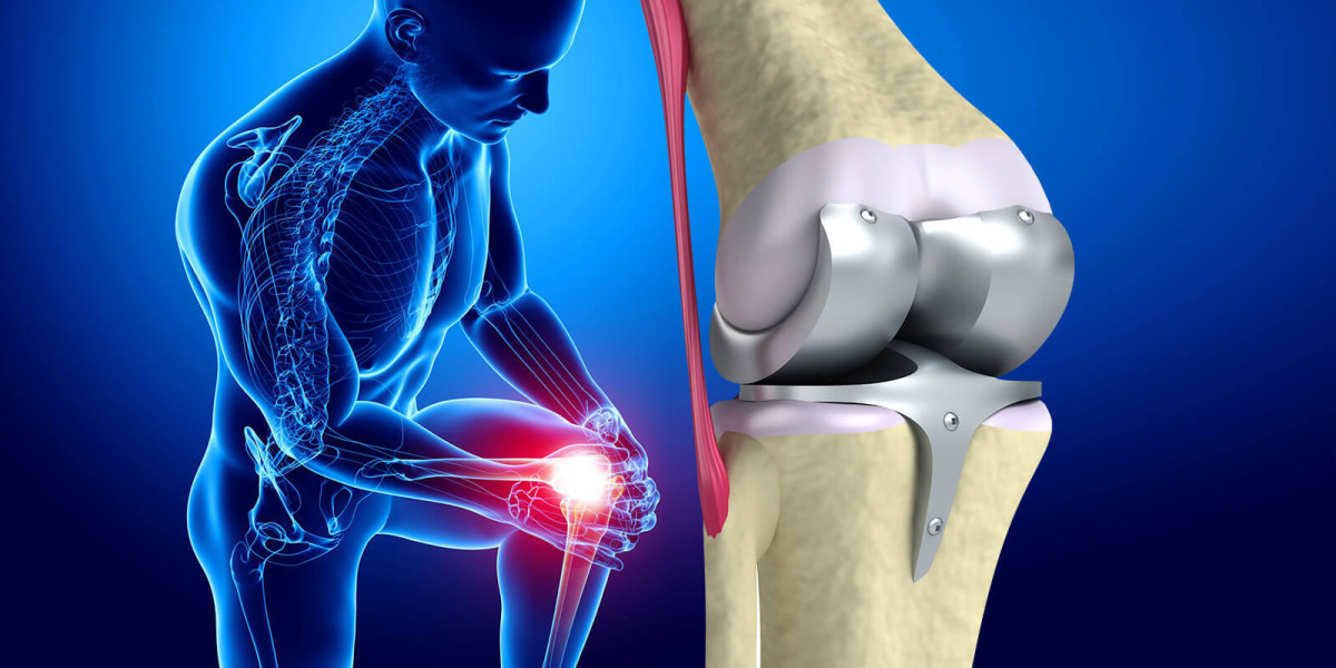 Innovative Solutions: Advancements in Knee Cartilage Replacements and Artificial Knees