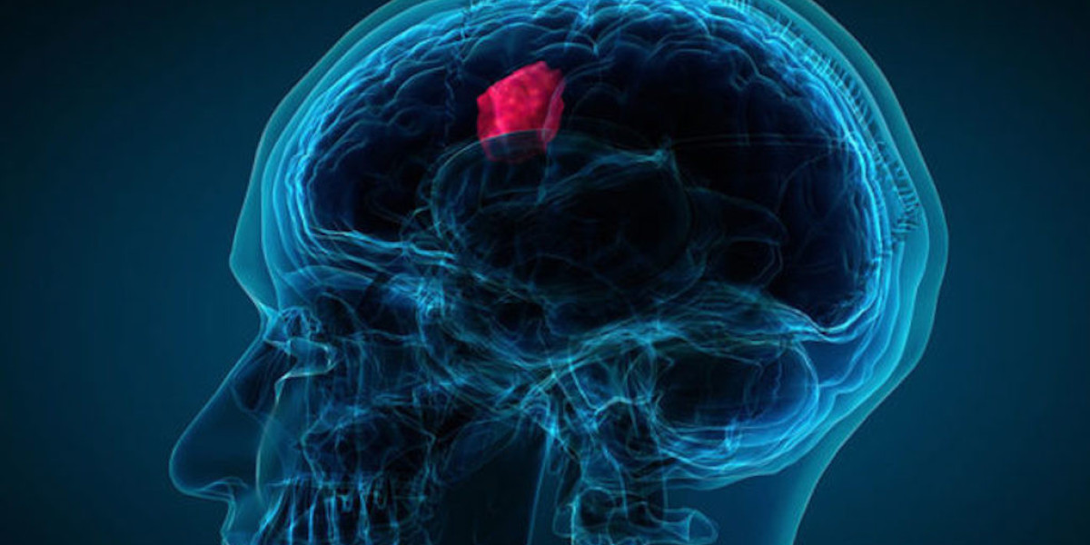 Technologically Advanced Devices to Bolster Growth of Pediatric Brain Tumor Market