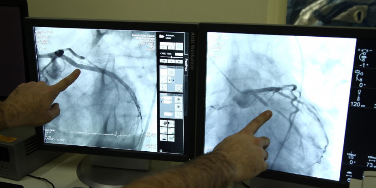 Challenges and Advancements: The Future of Coronary Angiography Devices