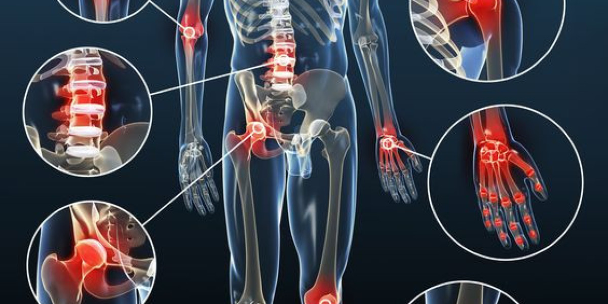 The Ultimate Guide to Sciatica Stretches for Nerve Pain Relief