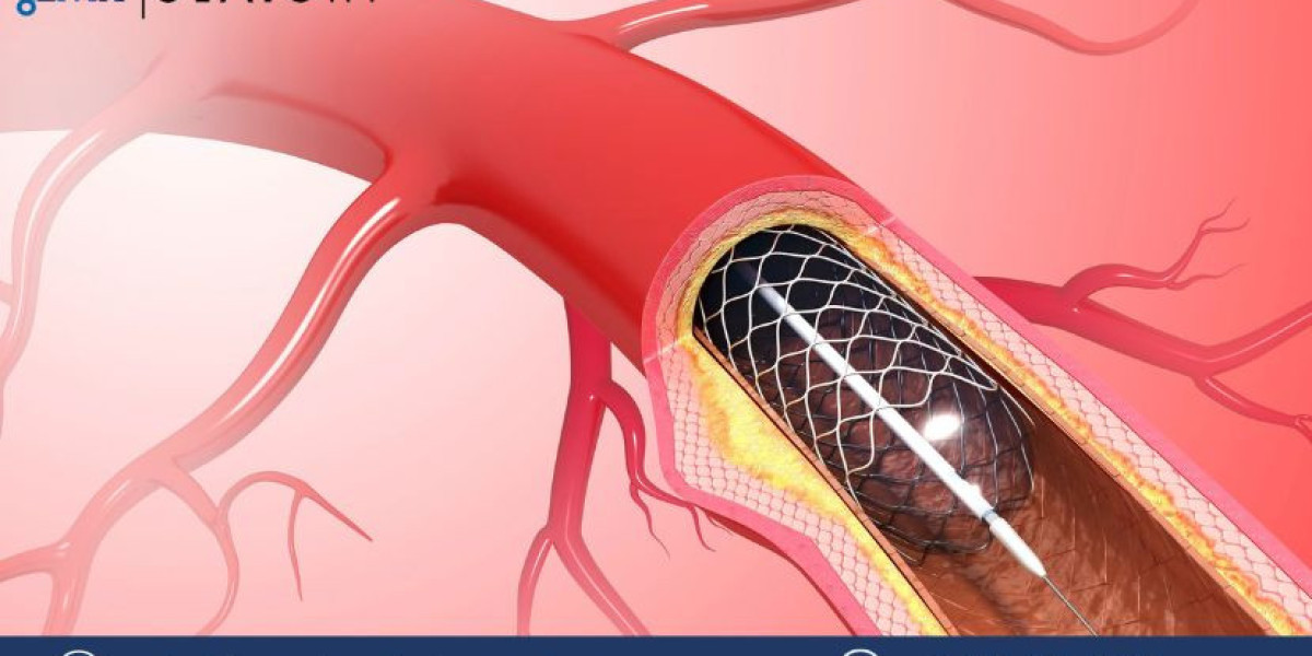 Venous Stents Market Size, Share, Trends, Growth, Report 2024-2032
