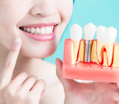 Experience the highly exclusive benefits of getting the best dental implants - Timber