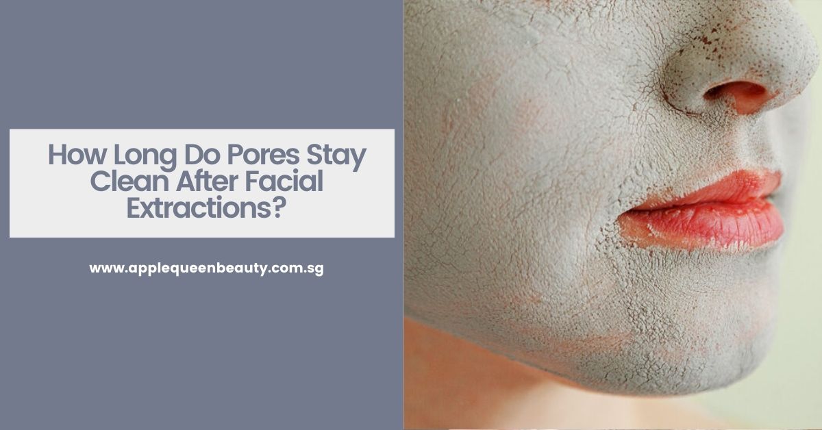 Facial Extraction - How Long Do Pores Stay Clean After