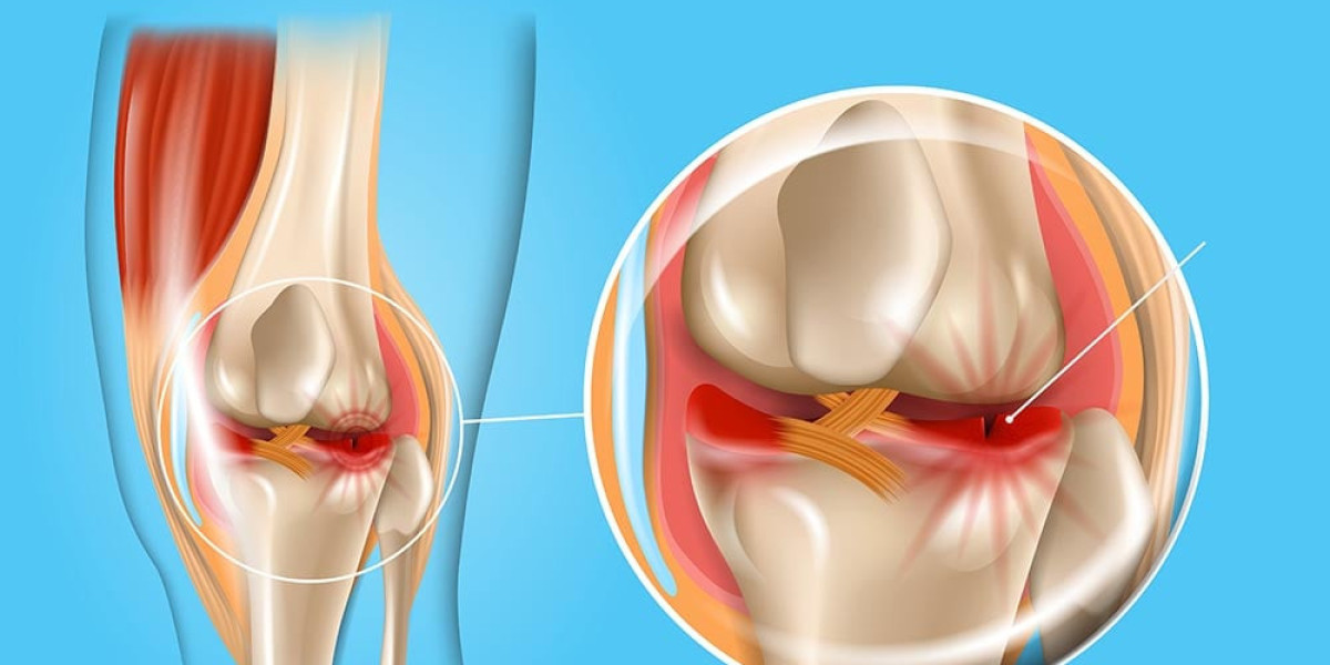 Meniscus Repair Systems: Advancing Treatment for Knee Injuries