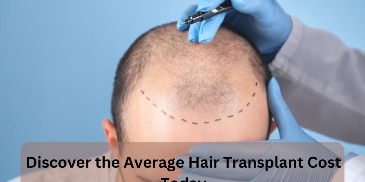 Discover the Average Hair Transplant Cost Today