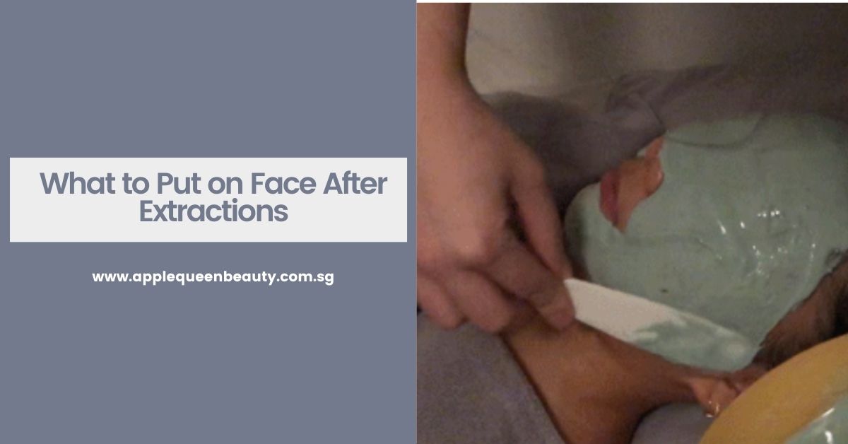 What to Put on Face After Facial Extraction - Acne Treatment