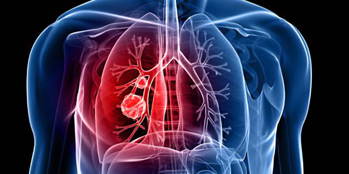 Respiratory Tract Infection Treatment : Causes, Symptoms, and Treatment Approaches