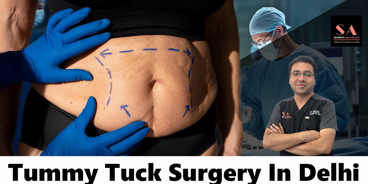 What is a 360 tummy tuck? 