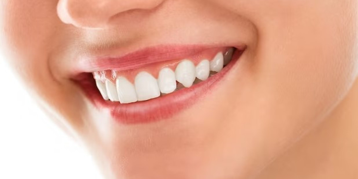 A Comprehensive Overview of Teeth Whitening Laser Treatments