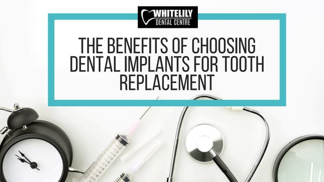 The Benefits of Choosing Dental Implants for Tooth Replacement | PPT