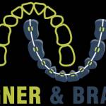 Aligner Braces