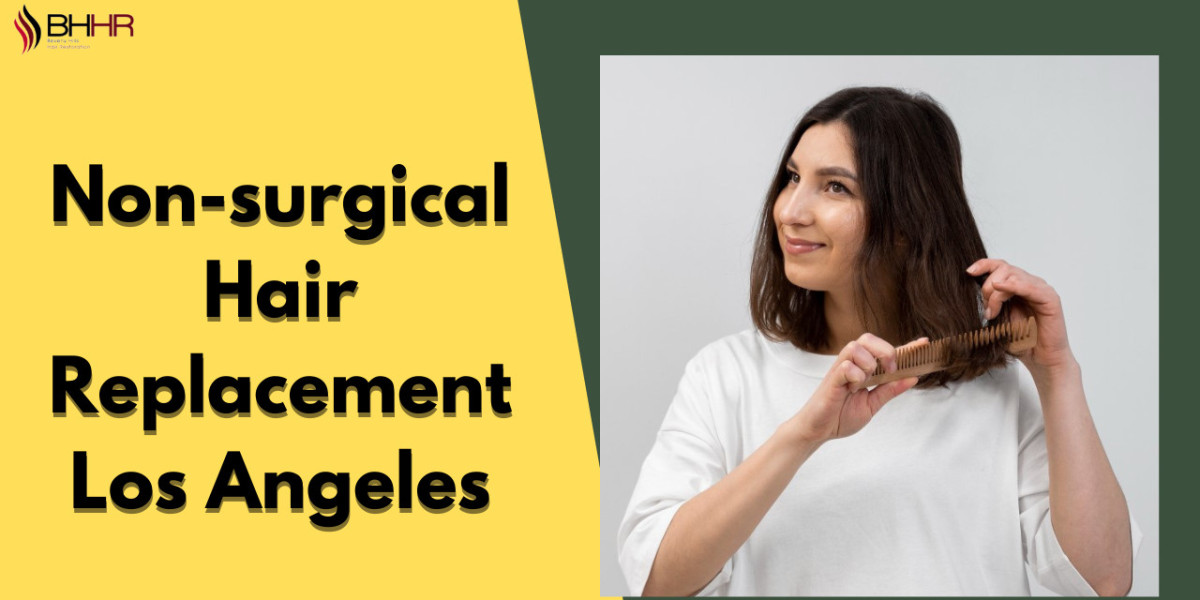 Why Nonsurgical Hair Replacement in Los Angeles is Popular