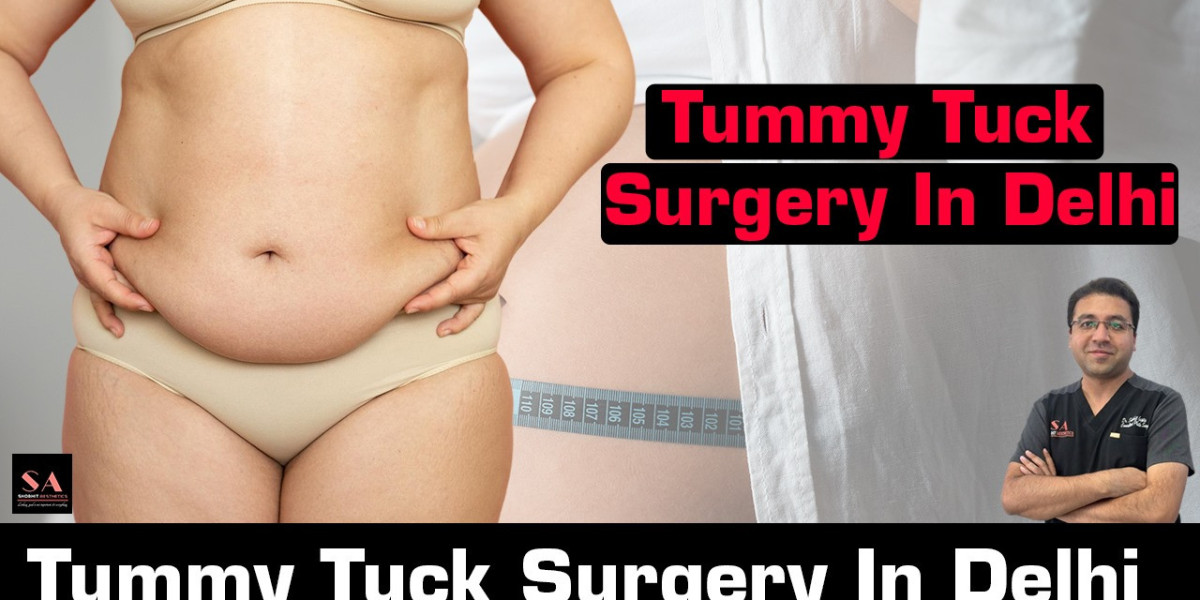 Trusted Tummy Tuck Surgery in Delhi - Quality Care