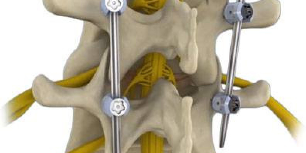 Spine Decompression Surgery: Relief from Pain and Improved Mobility