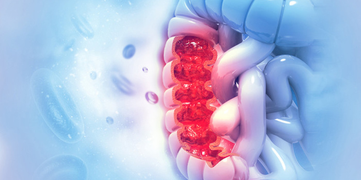 Colorectal Cancer Therapeutic Market Size, Growth & Industry Analysis Report, 2032