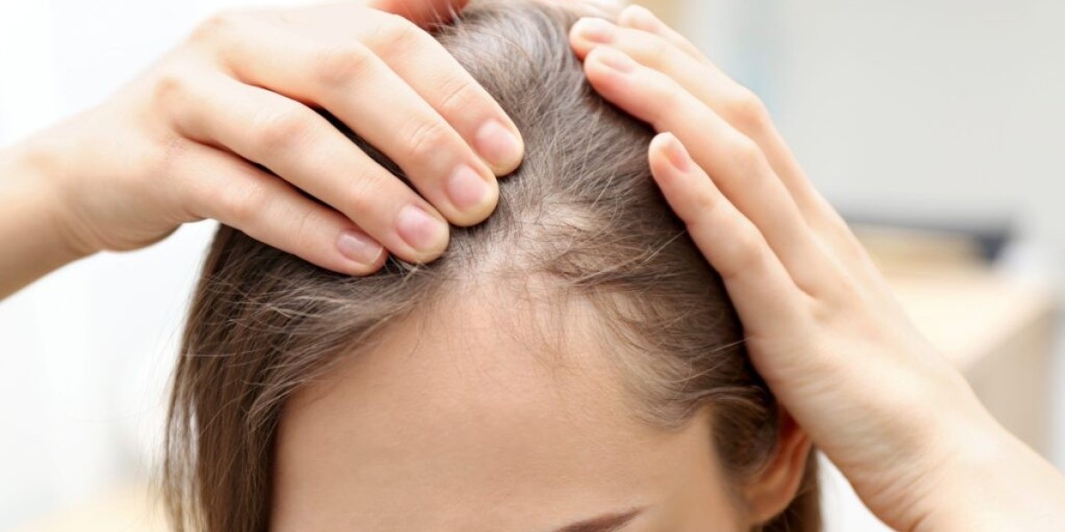 Alopecia Treatment Market Poised to Witness High Growth due to Stem Cell Therapy Advancements