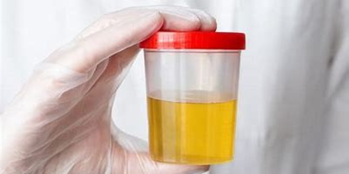 Clinfinite Solutions provides the best Urine Sample collection services.