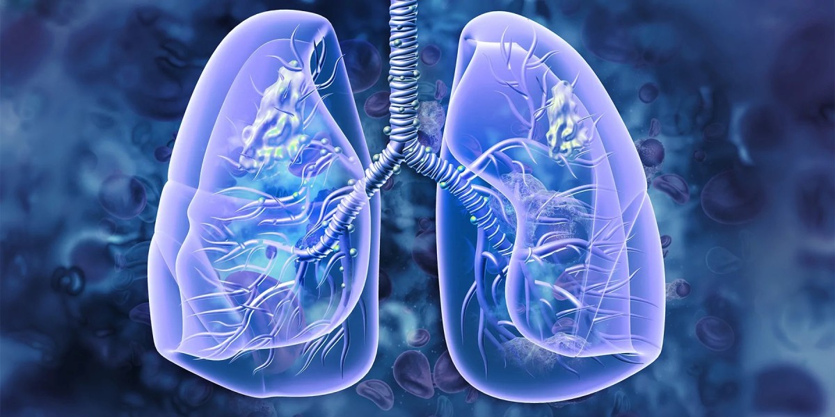 Lung Cancer Screening Market Latest Trend and Business Attractiveness 2024 to 2031