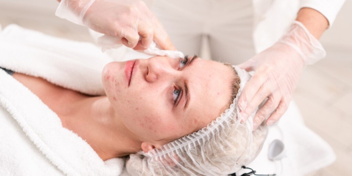 Refresh Your Look: Best Cheap Facial Treatments in Singapore