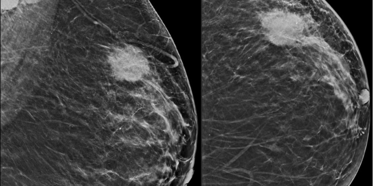 Breast Imaging Market Size Trends And Growth Analysis