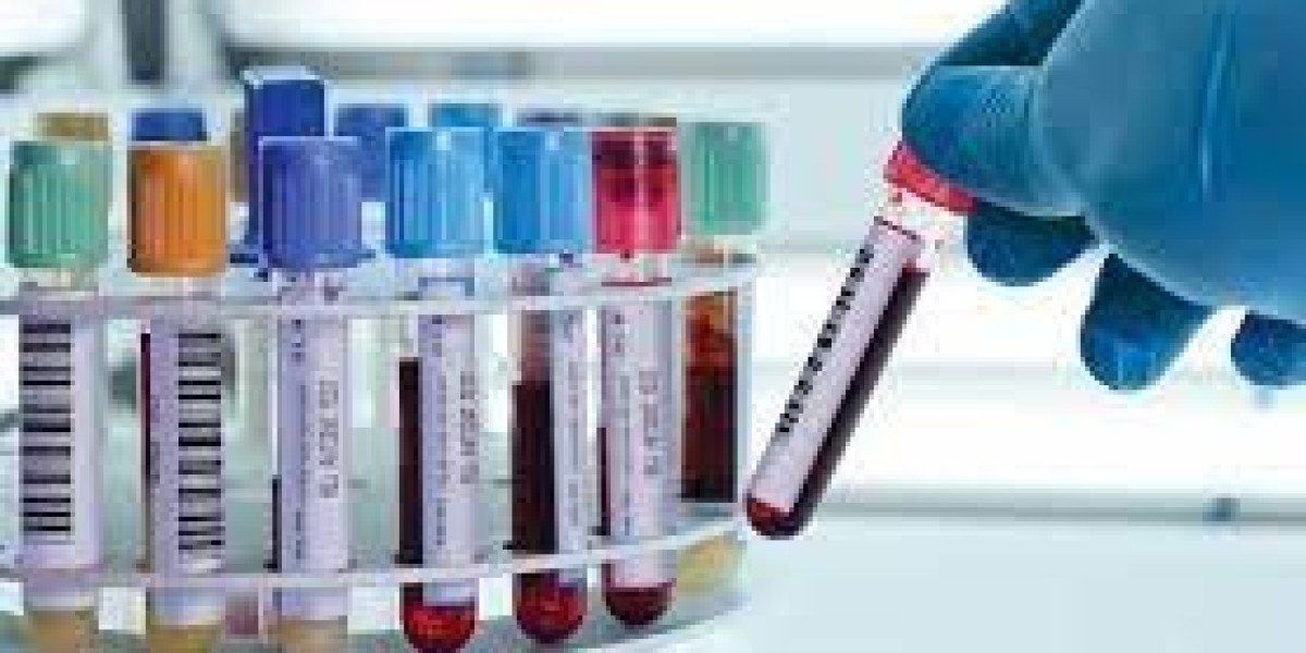 Clinfinite Solution's Optimizing Blood Collection for Clinical Research