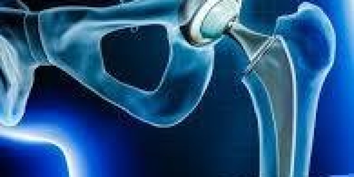 Hip Replacement Market Size Forecast Report 2024-2030