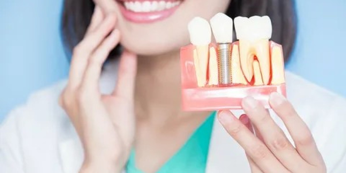 The Most Common Myths About Dental Implants in Islamabad