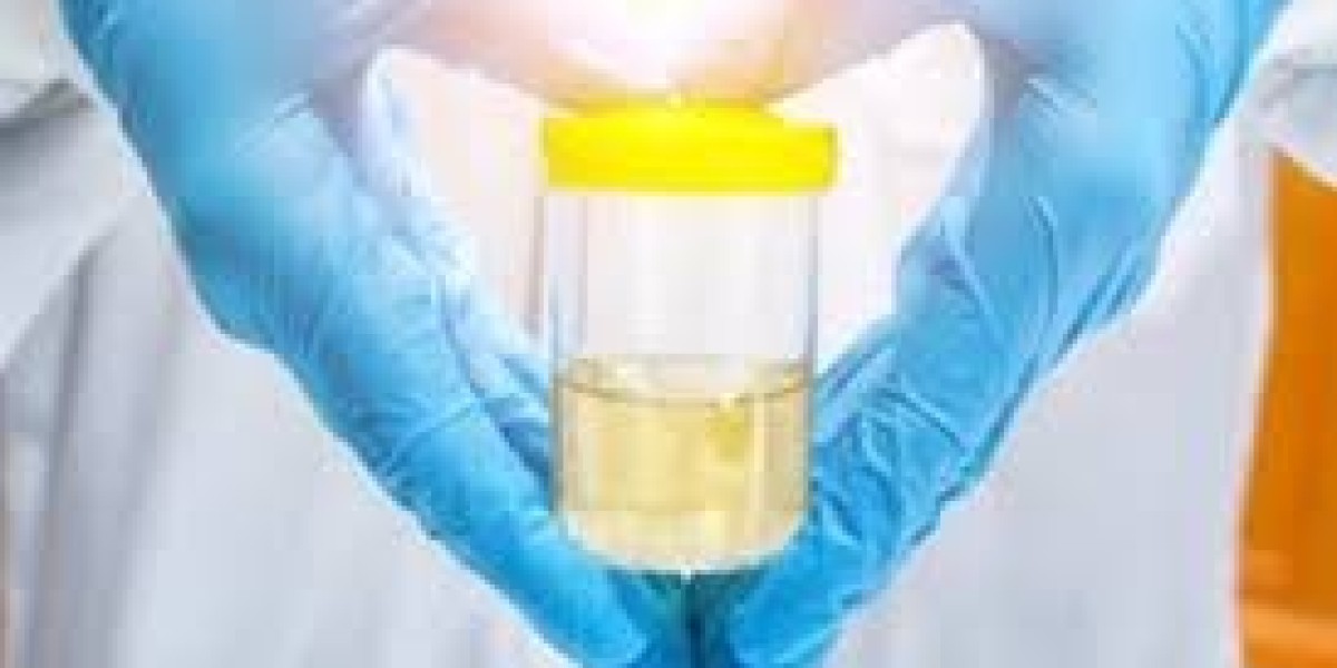 Clinfinite Solutions provides the best Urine Sample Collection services