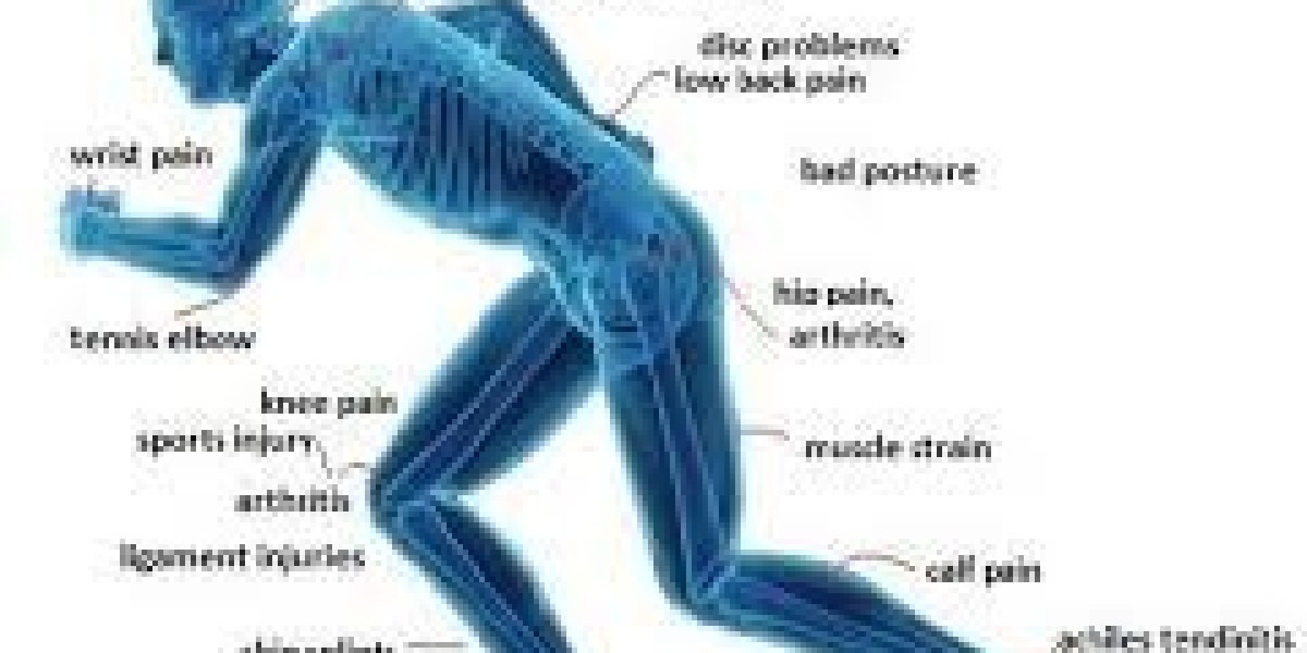 Soothe the Strain: Effective Treatments for Muscle Aches with Carisoprodol