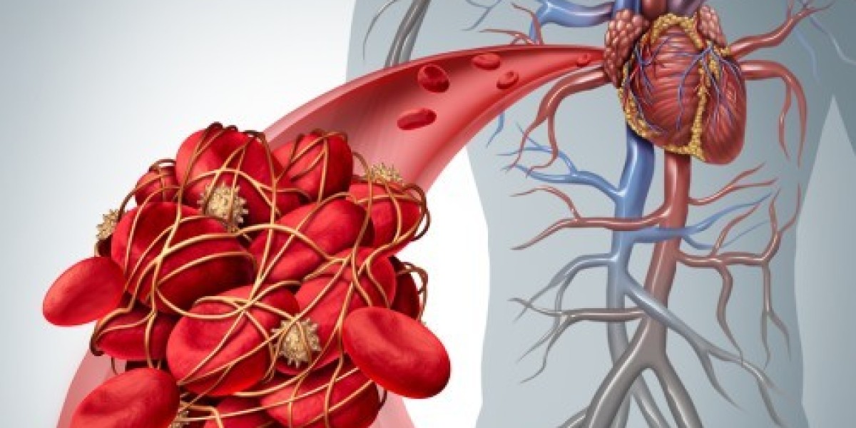 The Growth Of The Thrombus Collection Equipment Market