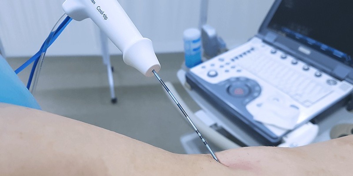 Radiofrequency Ablation Devices For Pain Management: An Overview