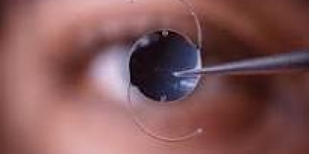 Intraocular Lens Market Size Forecast Report 2024-2032