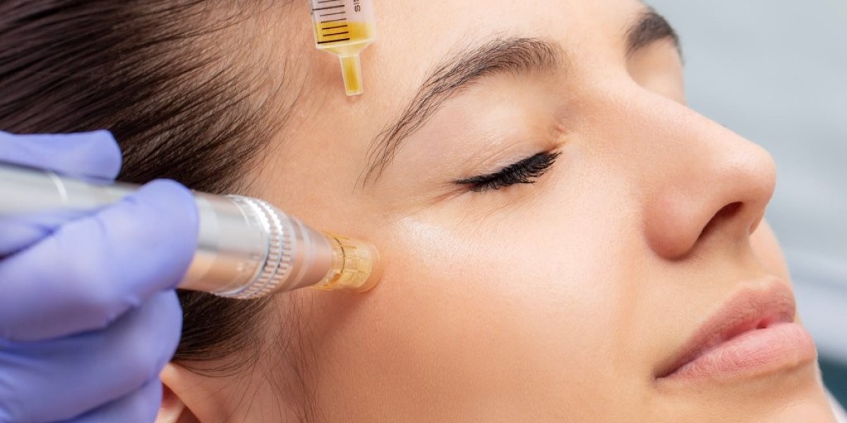 Rejuvenate Your Skin with PRP Microneedling Services