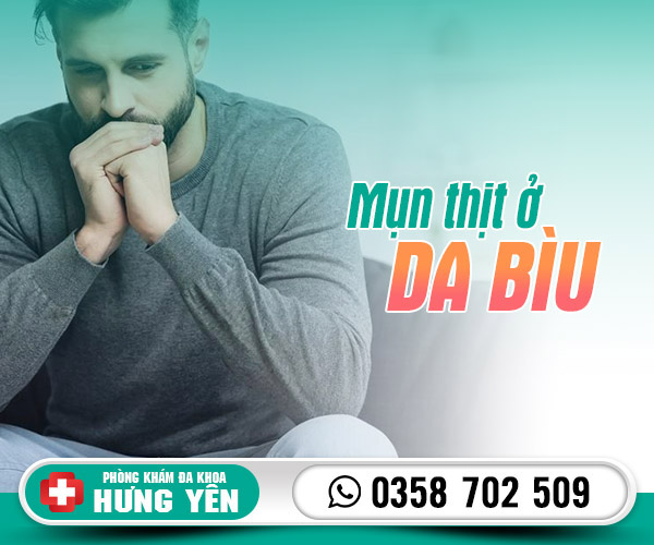 Mụn thịt ở da bìu là bị làm sao? Có nguy hiểm không?