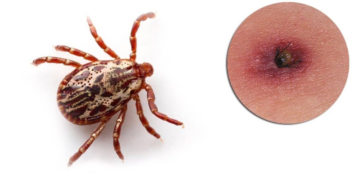 A Closer Look at Lyme Disease Treatment Options