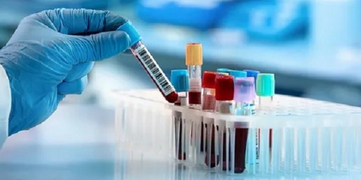 Hematology Diagnostics Market Growth Supported by Rising Geriatric Population and Chronic Diseases