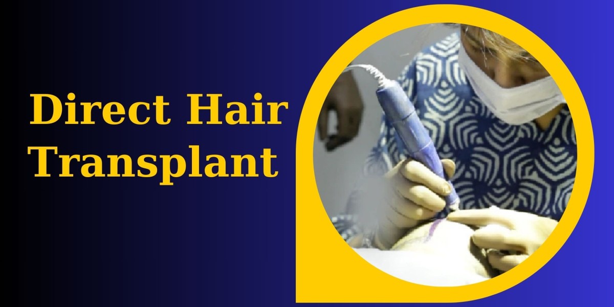 Change Your Look with Direct Hair Transplant in Delhi