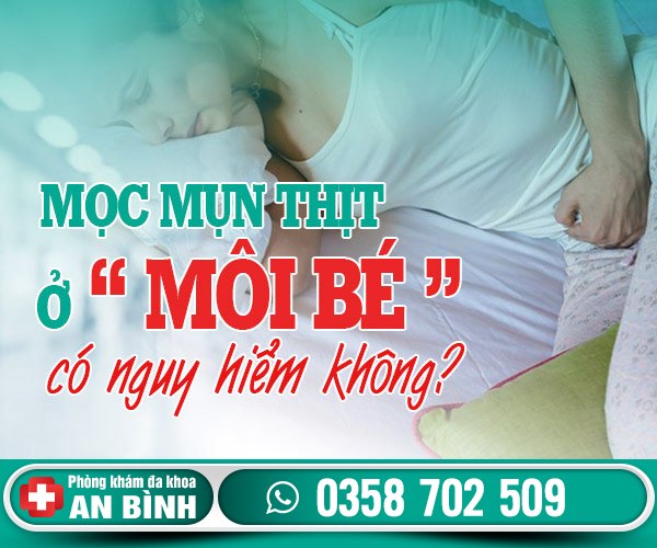 Giải đáp: Mọc mụn thịt ở môi bé là dấu hiệu của bệnh gì?