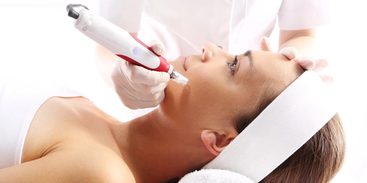 Is Microneedling Right for Sensitive Skin in Islamabad?