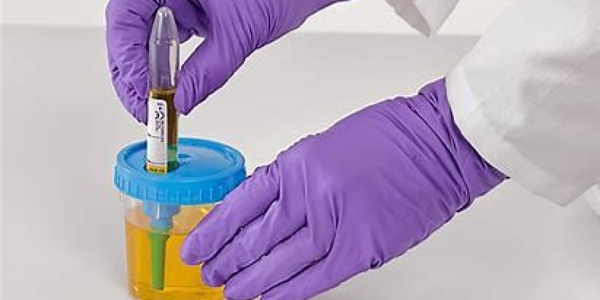 Best Urine Specimen Collection Methods In Hyderabad