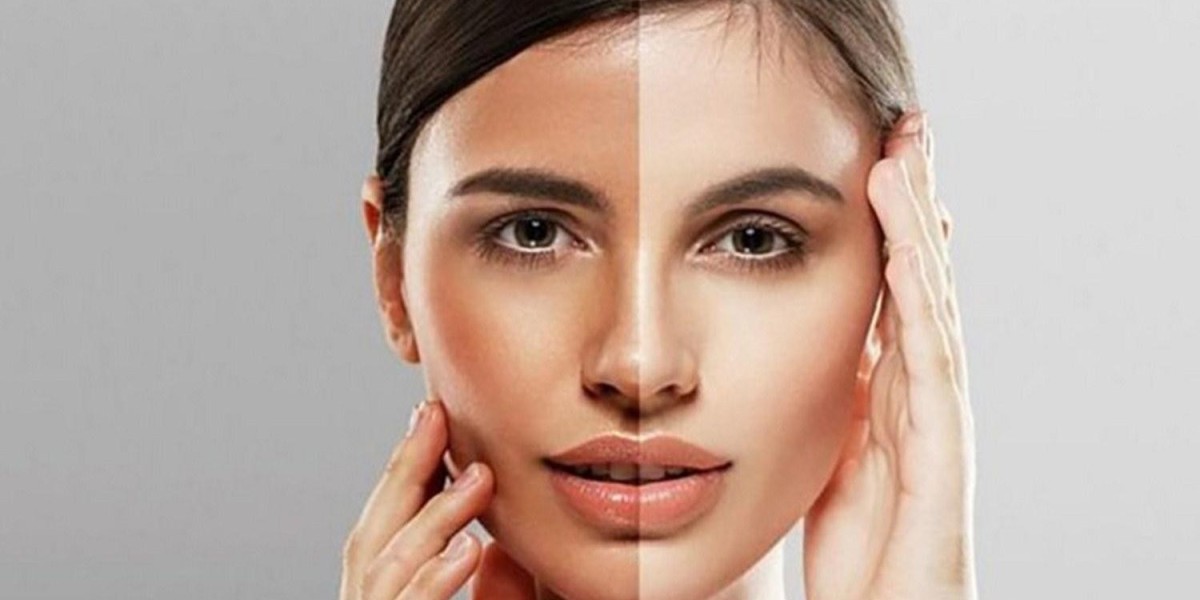 Post-Treatment Care for Skin Toning: Tips for Long-Lasting Results