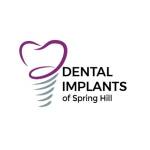 Dental Implants Spring Hill