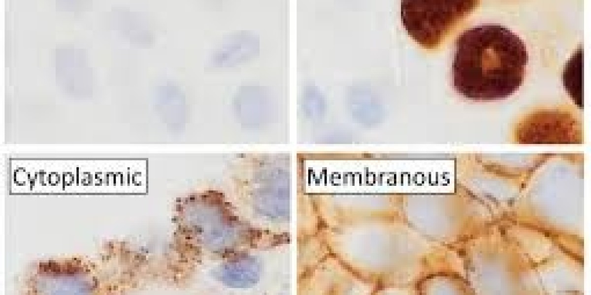 IHC Techniques Improve Drug Development & Therapeutic Targeting