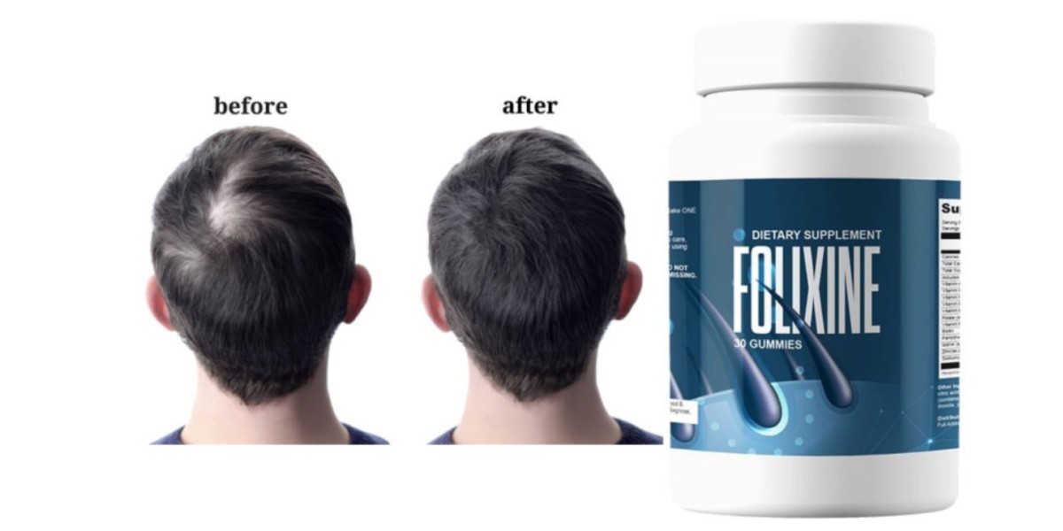 Folixine Hair Regrowth Gummies Reviews [Updated 2025]: Know All Details